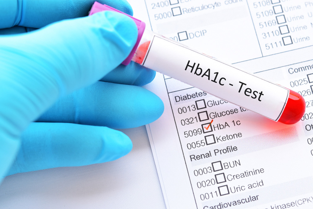 Hemoglobin-A1C-photo